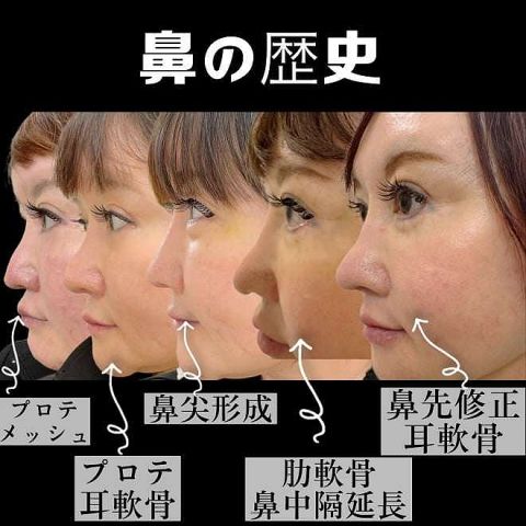 “整形大好き”54歳女性、4,500万かけて外見を磨き続けるワケ「綺麗な子に対する人の対応を如実に感じてしまう」